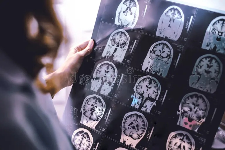 Brain Injury Lawyer Orlando